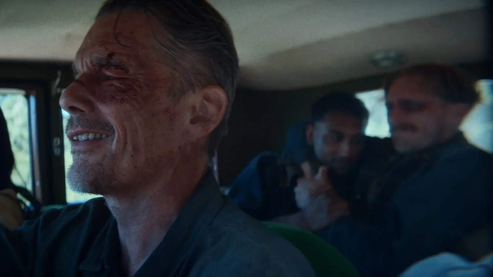 رجل ذو جروح قرب عينه يبتسم داخل سيارة بينما يجلس رجلان في الخلف